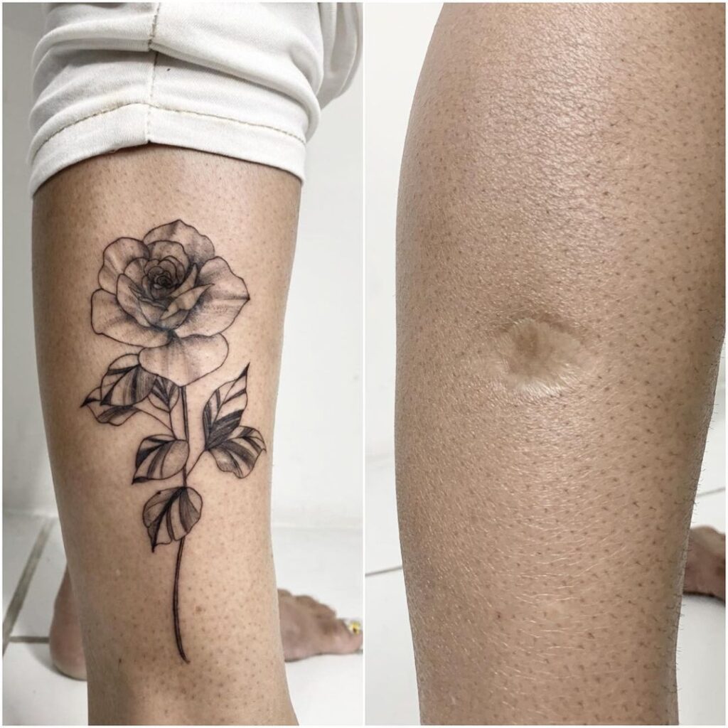 Tatuagem para cobrir cicatriz