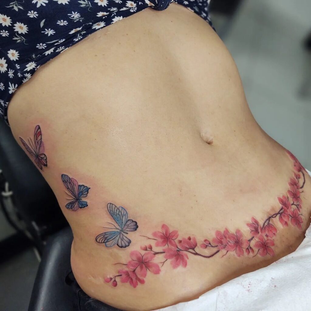 Tatuagem correção cicatriz barriga