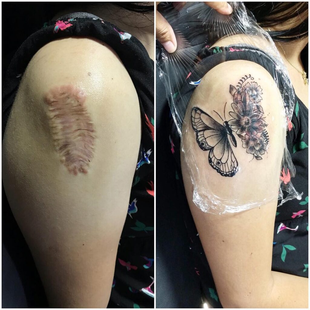 Tatuagem correção cicatriz no braço