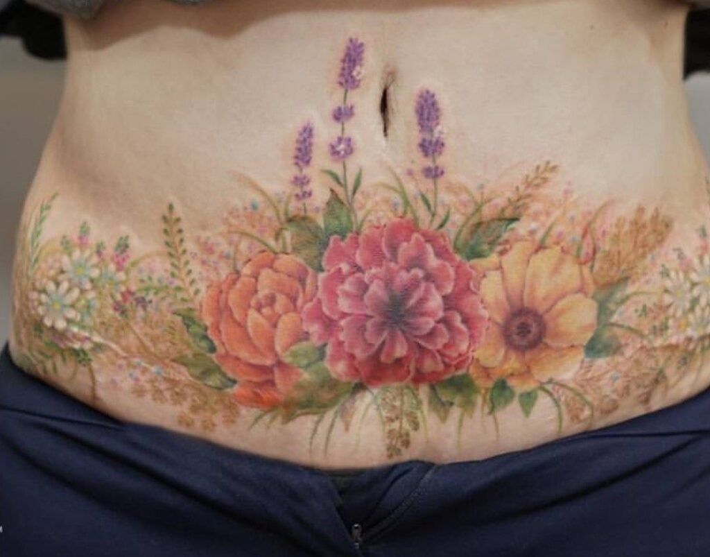 tatuagens para cobrir cicatriz na barriga
