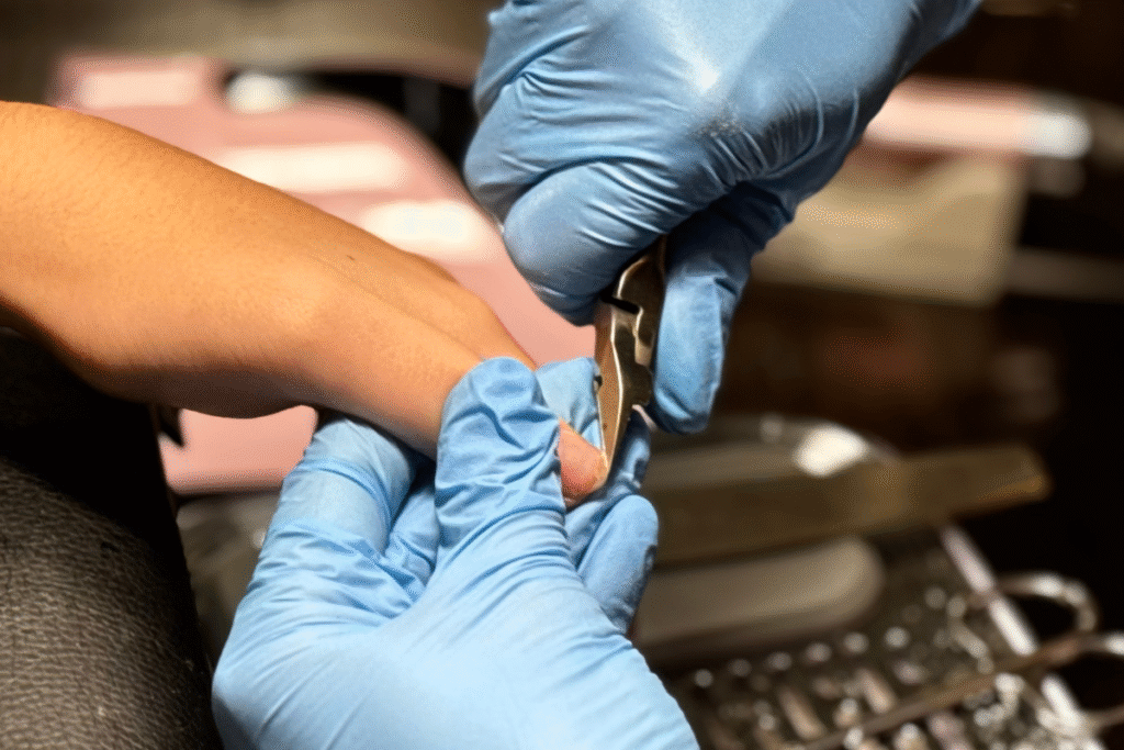 Benefícios da Cutilagem